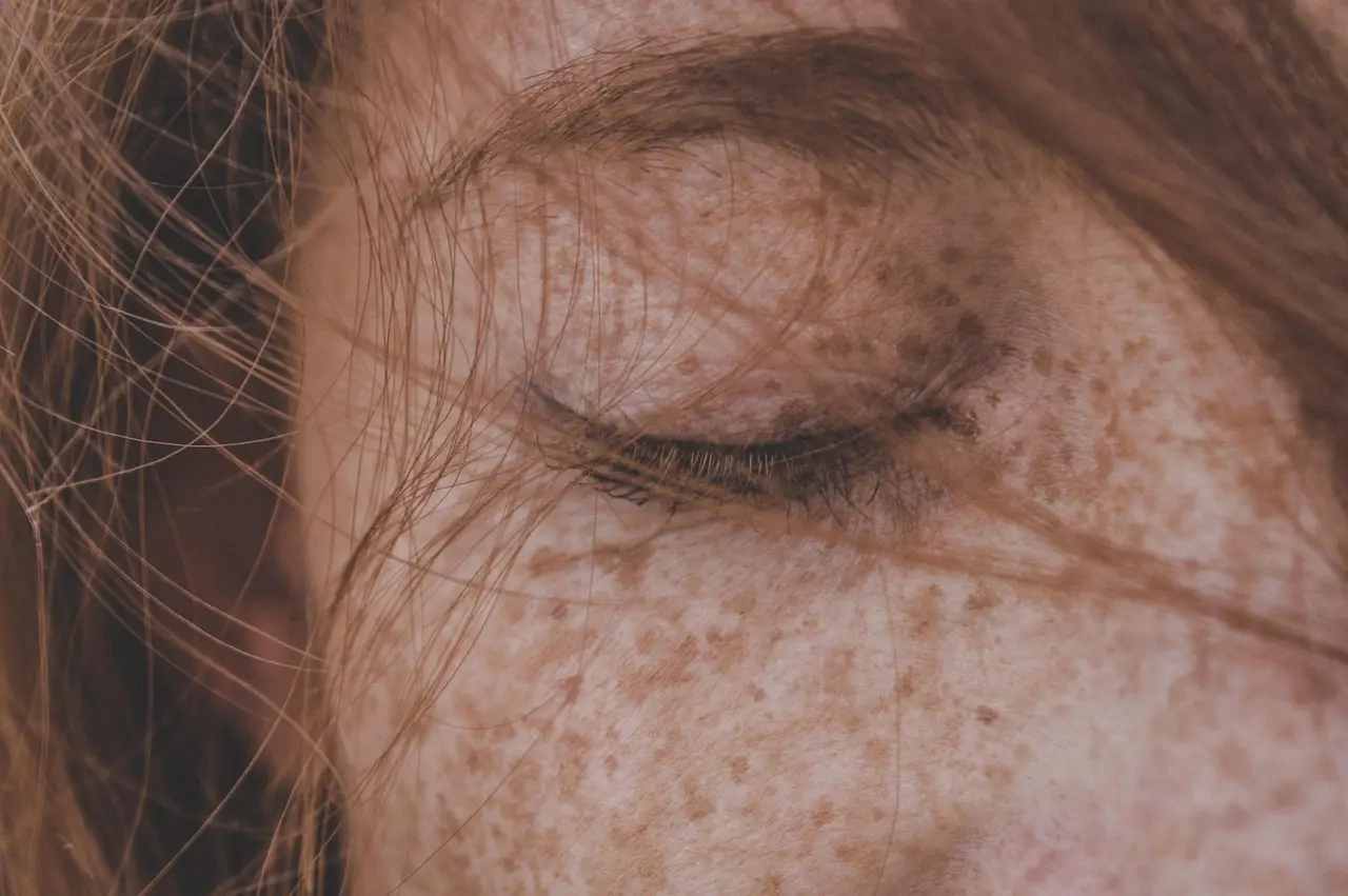 SkinBench: six AI models saw skin problems that were not there